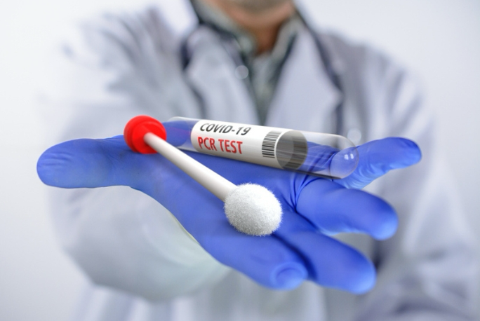 COVID-19 RT-PCR Test